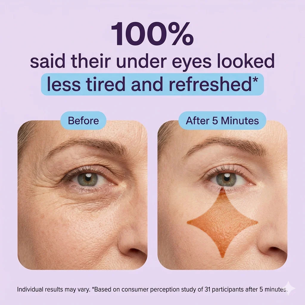 Tiworld™ Instant Lift Eye Gel