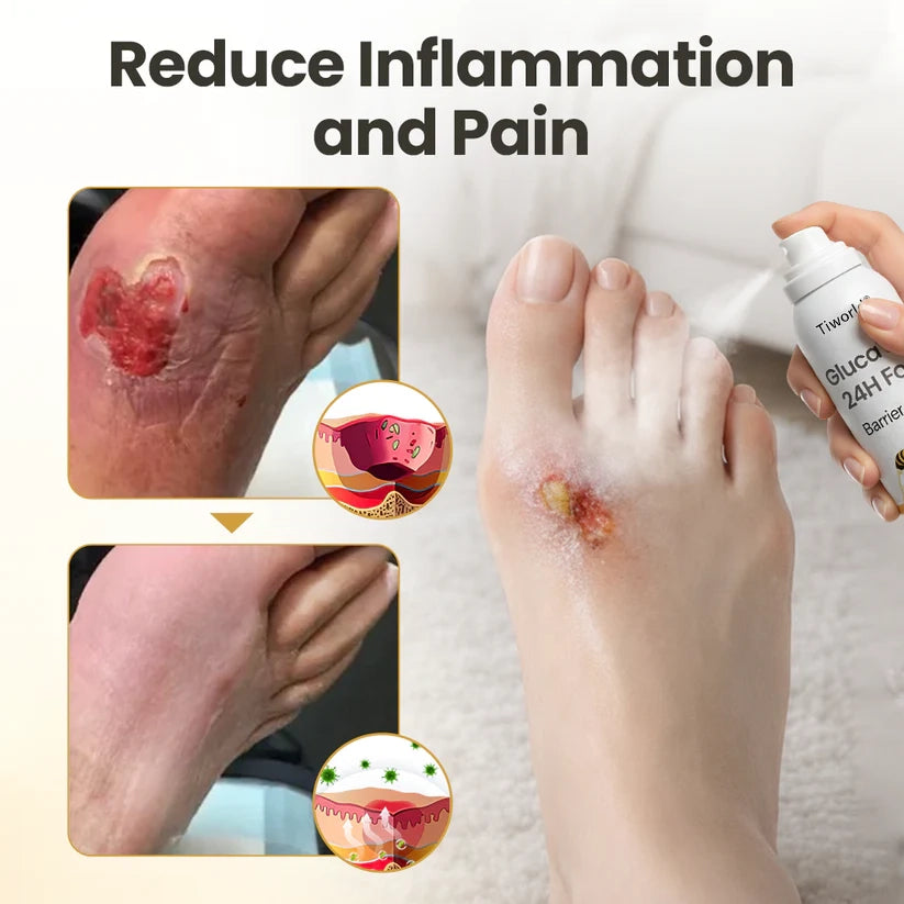 Tiworld® GlucaVeil 24H Foot Barrier Spray