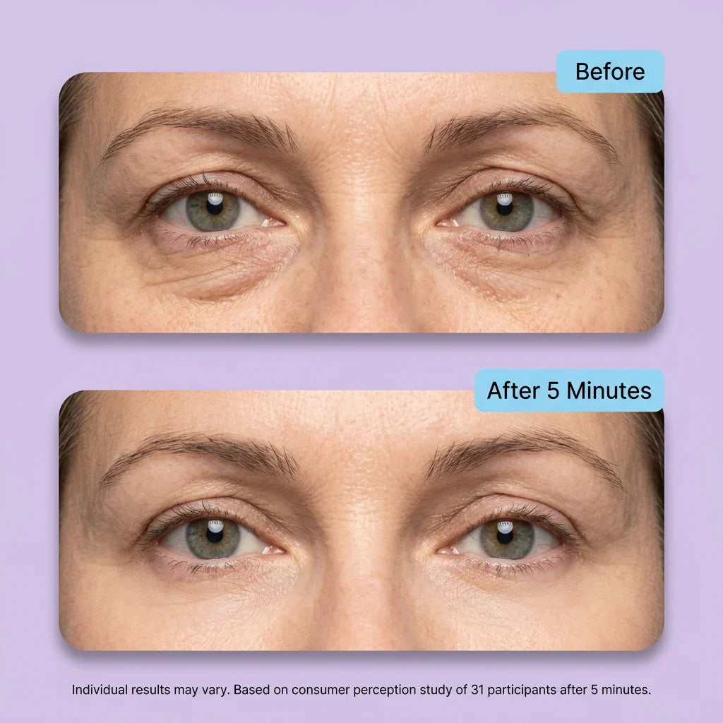 Tiworld™ Instant Lift Eye Gel