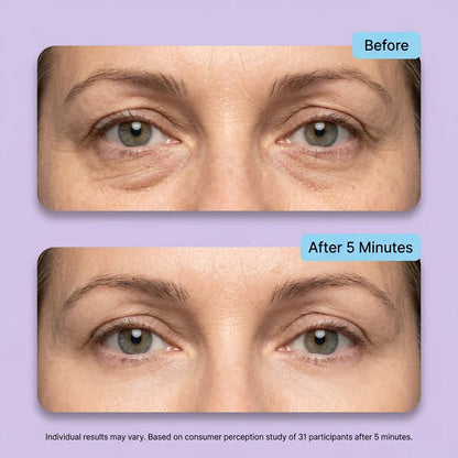 Tiworld™ Instant Lift Eye Gel