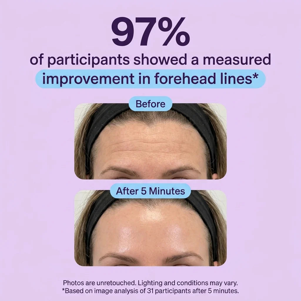 Tiworld™ Instant Lift Eye Gel