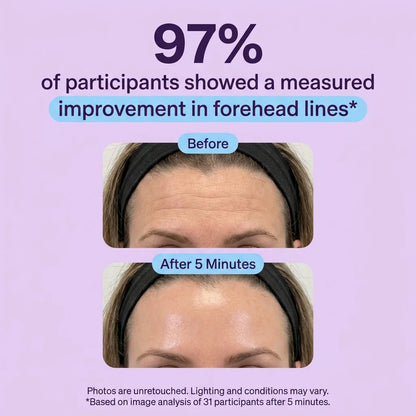 Tiworld™ Instant Lift Eye Gel